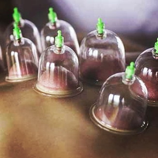 Hijama cupping manchester for women only