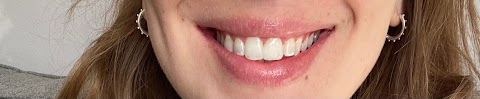 Natural White | Teeth Whitening & Veneers