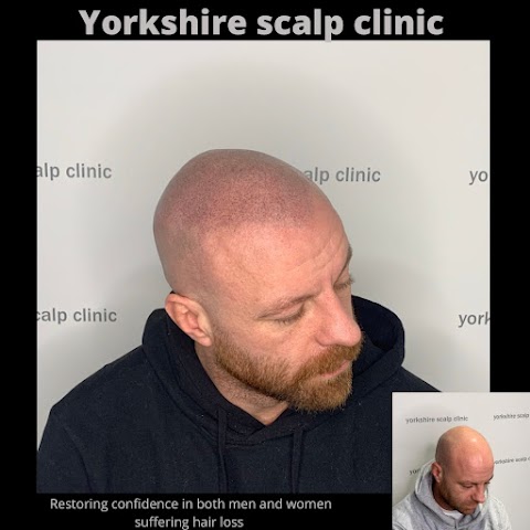 Yorkshire scalp clinic