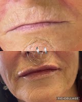 Astharr Aesthetics (fillers and Botox)