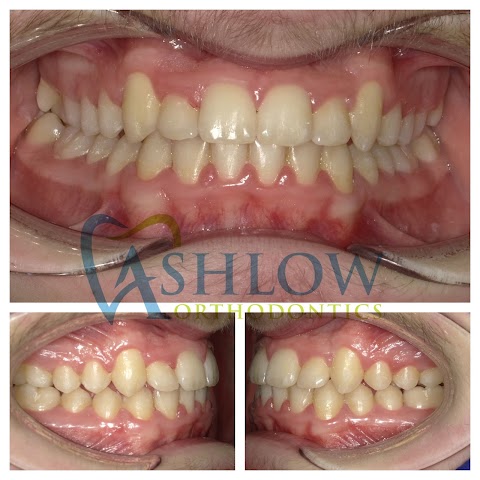 Ashlow Orthodontic Practice