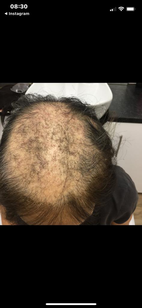 Hairlossandscalpclinic