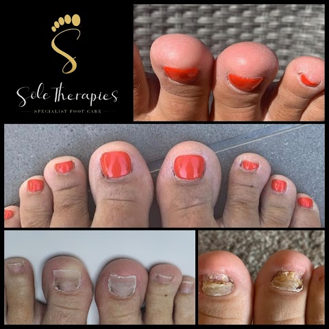 Sole Therapies
