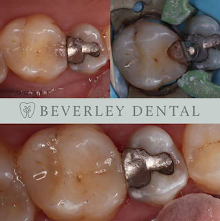 Beverley Dental