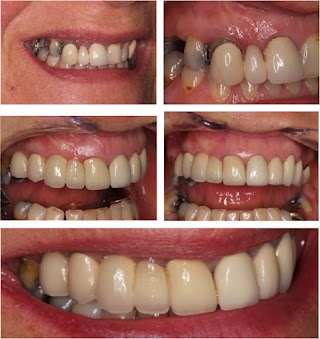 Soni Dental Implants