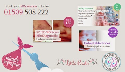 Ultrasound Direct Leicester - Babybond