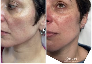 Smart skincare & aesthetic