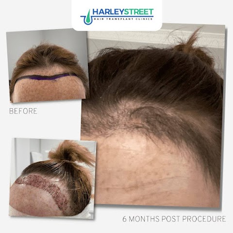 Sheffield Hair Transplant Clinic