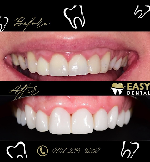 Easy Dental Liverpool