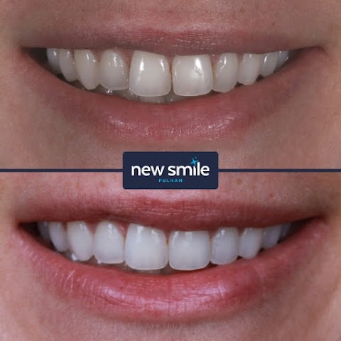 New Smile Fulham