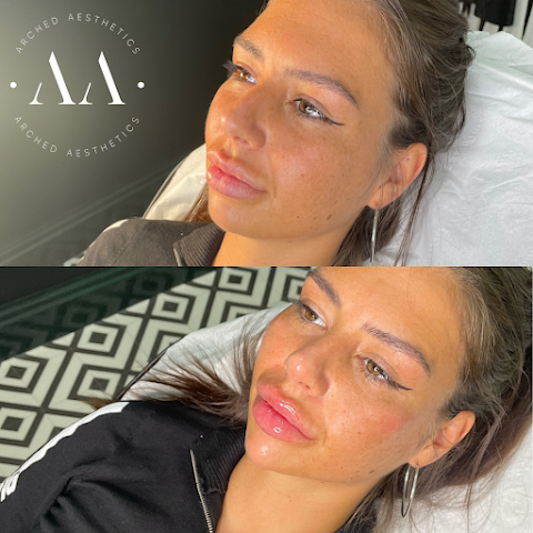 Arched Aesthetics | Aesthetic Treatments & Lip Fillers Plymouth