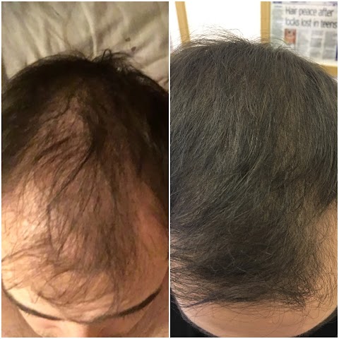 The Hair Loss Clinic