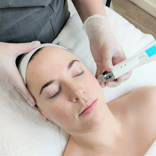 Harrow Microneedling Clinic - Affordable Microneedling Specialist