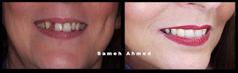 Dr Sam Ahmed Cosmetic and Implant Dentistry