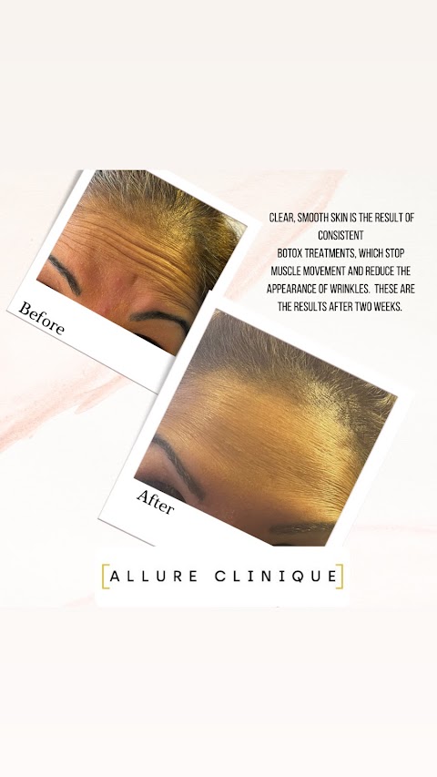 Allure Clinique