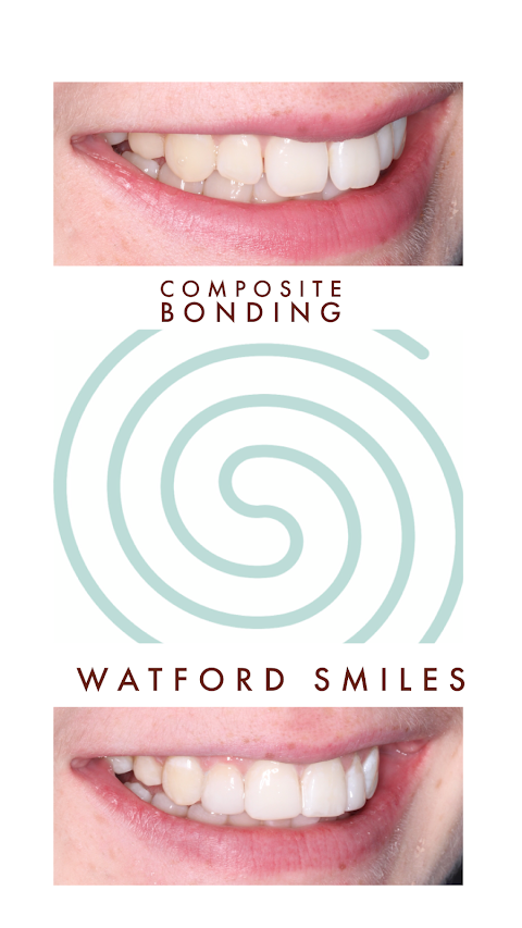 Watford Smiles Invisalign