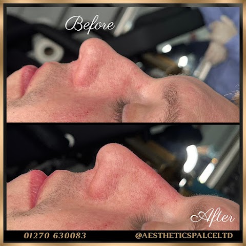 Aesthetics Palace Clinic - Cheshire