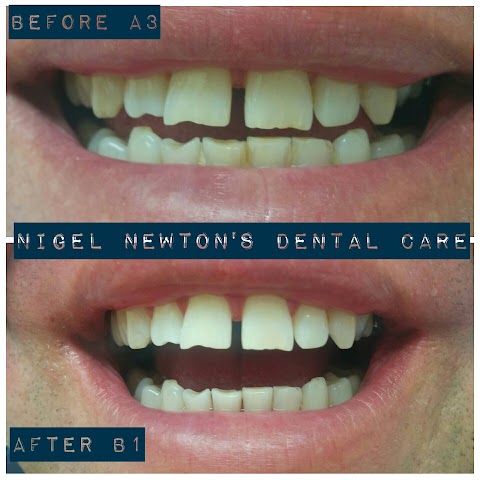 Nigel Newton's Dental Care