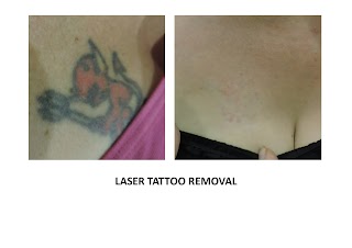 Laser Beauty Solutions