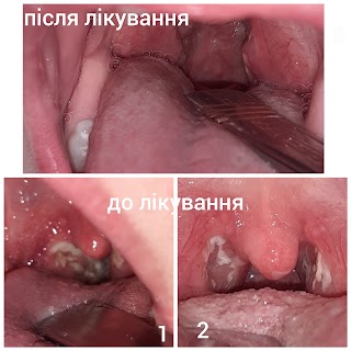 ЛОР кабінет Гарасимчук Р.В.