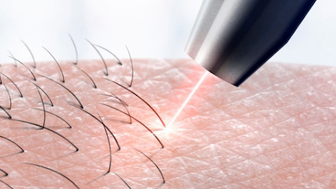 Metro Laser Clinic