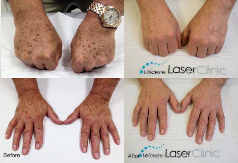 Leicester Laser Clinic LA