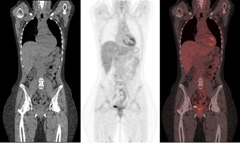 Department of Nuclear Medicine & PET-CT, King's College Hospital