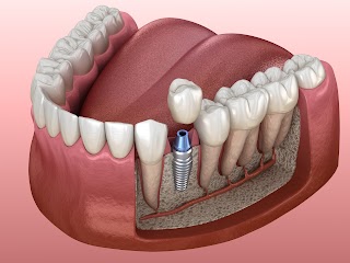 Dental Implant Centre Aberdeen