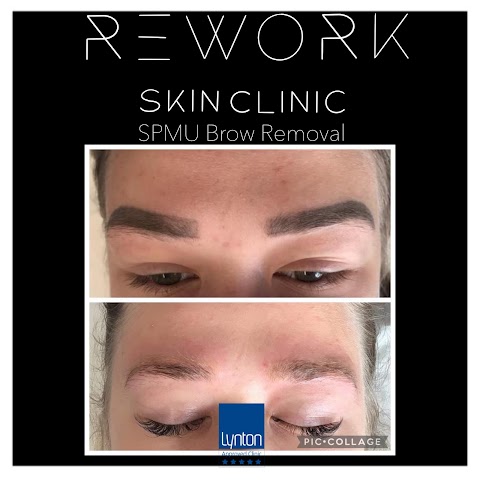 ReWork Skin Clinic