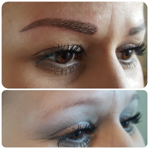 Redeem Microblading and Tattoo removal clinic