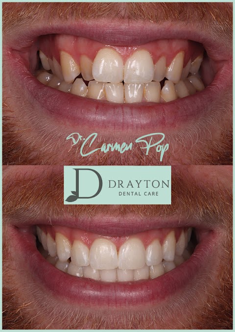 Drayton Dental Care