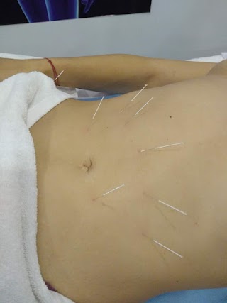 MOXAY Acupuncture Wellbeing Clinic