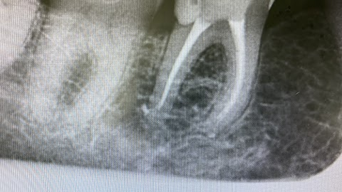 Mr I Charlesworth, Dentist With Enhanced Skills In Endodontics