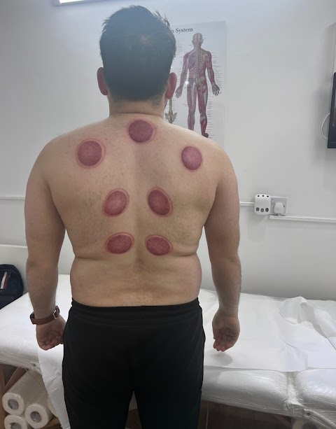 Hijama Manchester Cupping Clinic Ltd