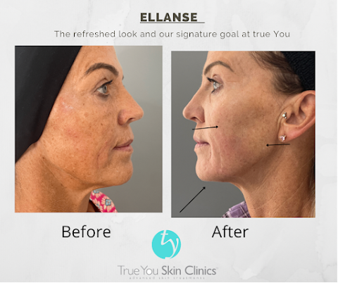 True You Skin Clinics