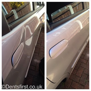 Dents First, Mobile Paintless Dent Removal. Nottingham, Derby, Mansfield PDR Since 1997