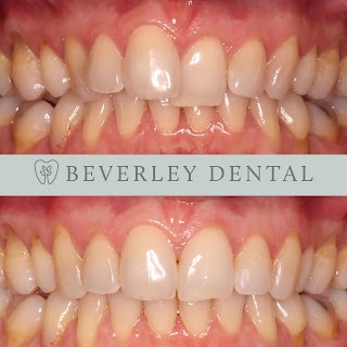 Beverley Dental