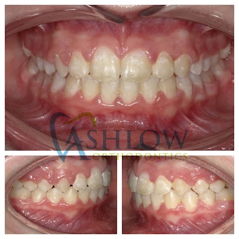 Ashlow Orthodontic Practice