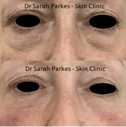 Skin Clinic