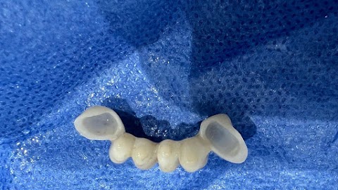 Herts Dental Watford Implant Dentist