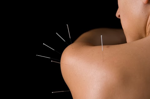Shaftesbury Acupuncture Clinic