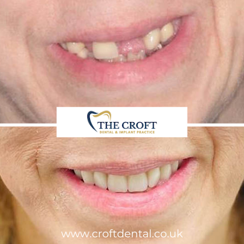 The Croft Dental & Implant Practice