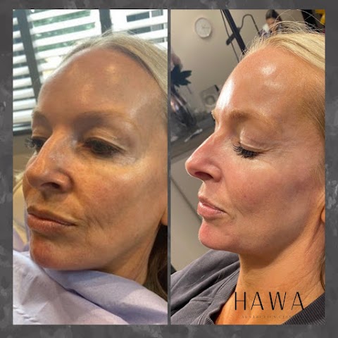 Hawa Aesthetics Clinic