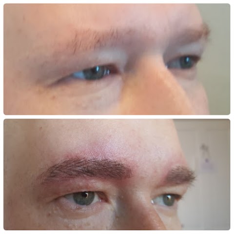 Redeem Clinic Microblading & Scalp micropigmentation