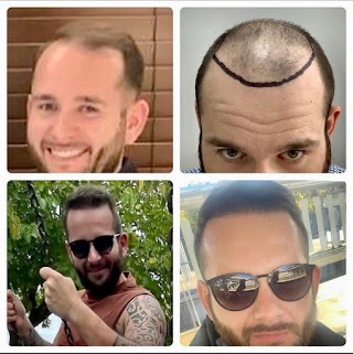 Bristol Hair Loss Clinic