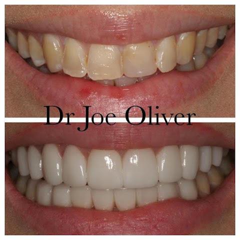 Dr Joe Oliver - Cosmetic Dentist Manchester Clinic