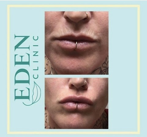 Eden Aesthetics Clinic Plymouth