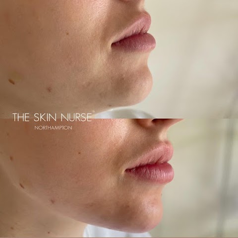 The Skin Nurse Northampton