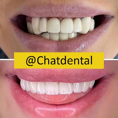 Chat Dental in Turkey