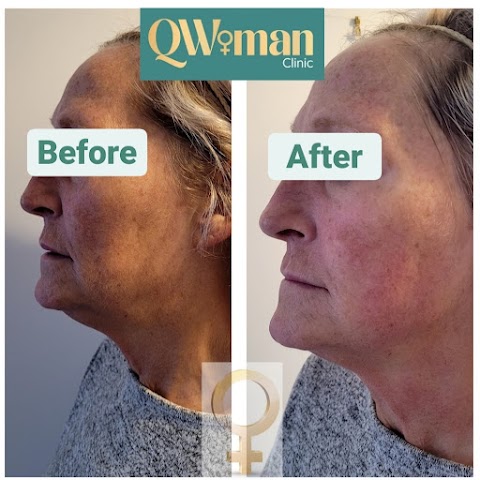 QWoman Clinic